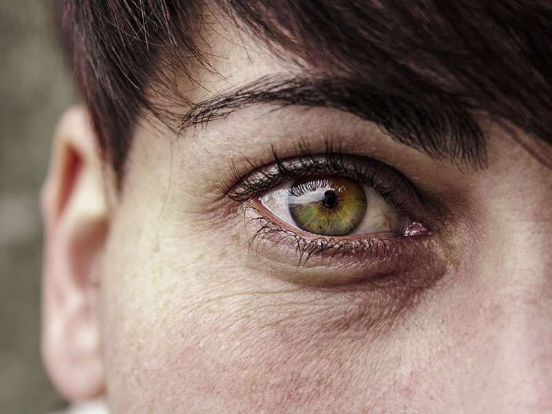 Die zarte Haut der Augenpartie braucht besondere Pflege